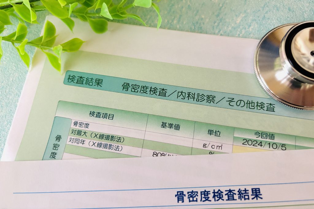 骨密度が低い人とは？基準値と骨粗しょう症との違い